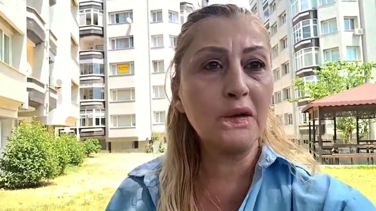 Estetik işlem sonrası dudağı çürüdü, 7 yıldır hukuk mücadelesi veriyor