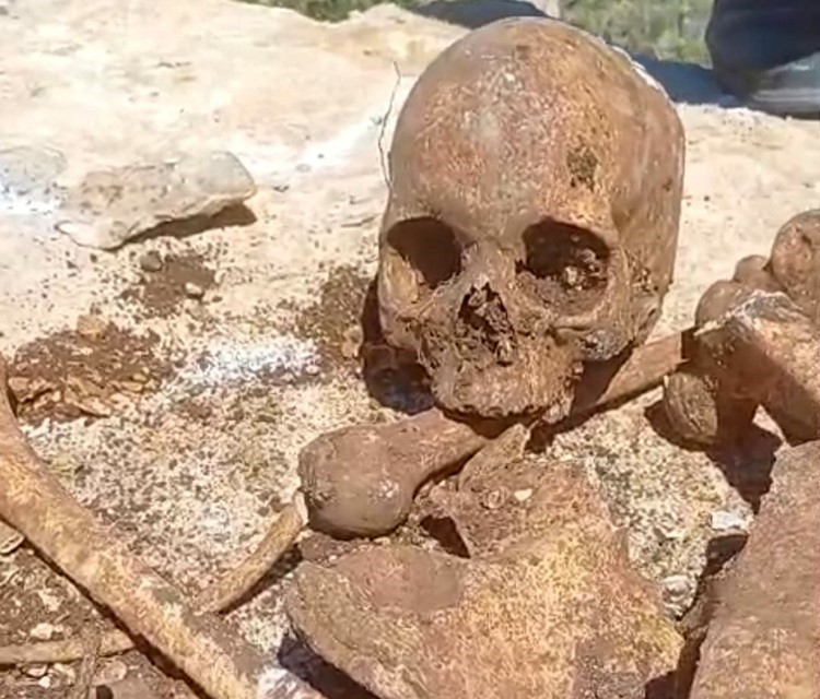Malatya’da temel kazısında insan kemikleri bulundu