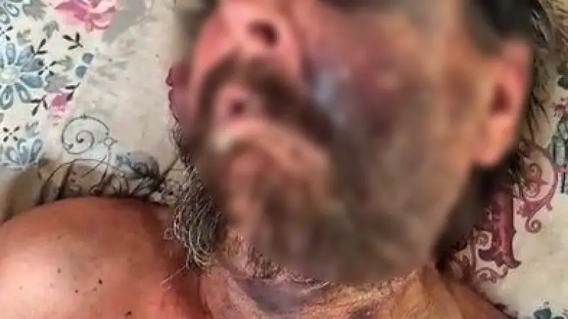 "Abimin cenazesine neden gelmedin" diyerek dövüp ölüme terk etmişler