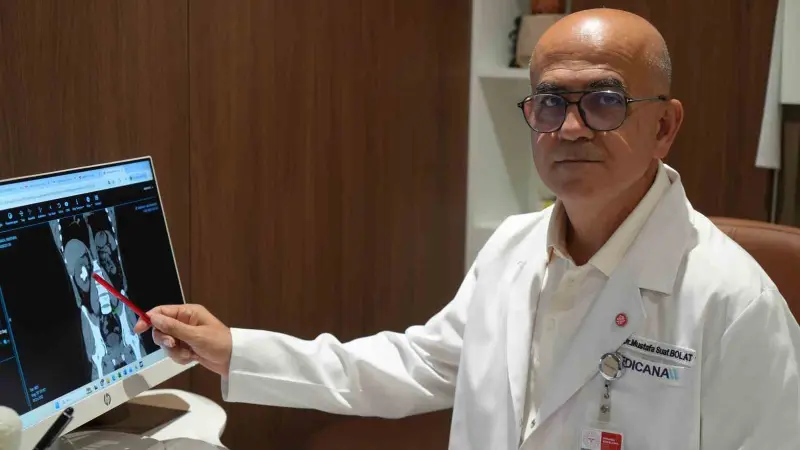 25 cm küplük böbrek taşı, hastanın sırtından girilerek çıkartıldı